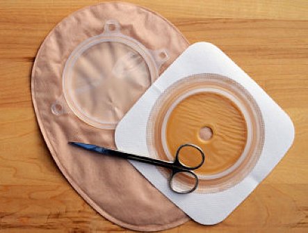 ostomy supplies